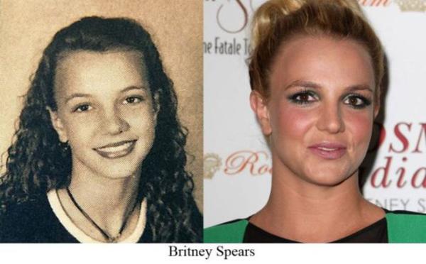 34 fotos de antes e depois de algumas pessoas 5